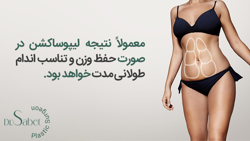 جراحی لیپوساکشن