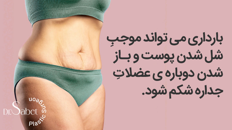 برگشت شکم بعد از ابدومینوپلاستی