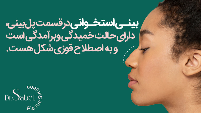 بینی استخوانی جراحی زیبایی بینی