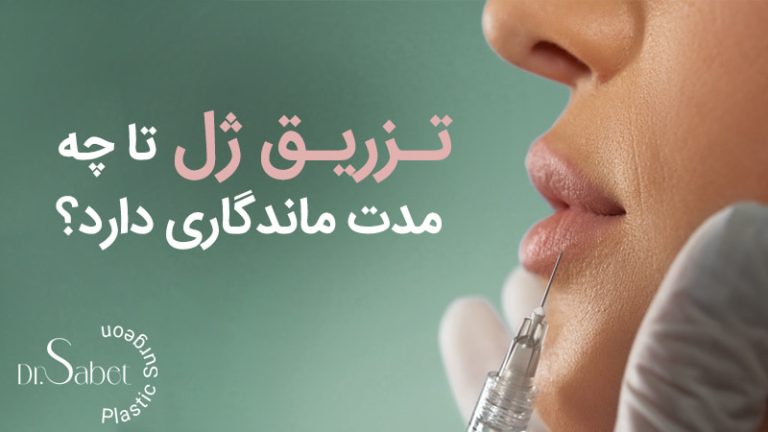 ماندگاری تزریق ژل