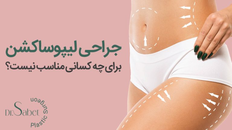 جراحی لیپوساکشن برای چه کسانی مناسب نیست