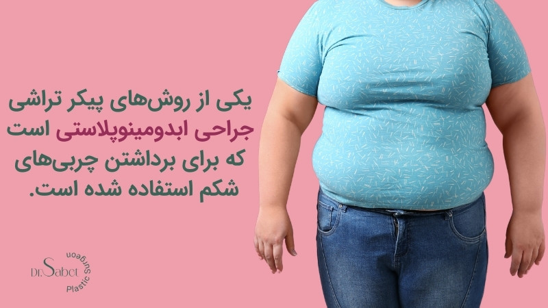 جراحی ابدومینوپلاستی یکی از روشهای پیکرتراشی است