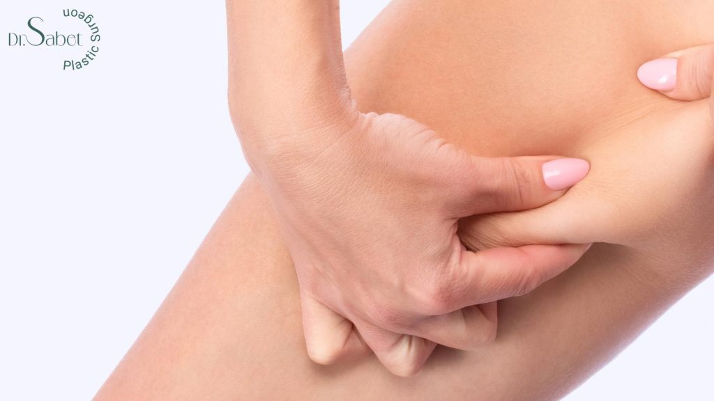 مراقبت‌های بعد از لیپوساکشن ران