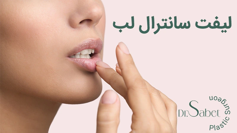لیفت سانترال لب