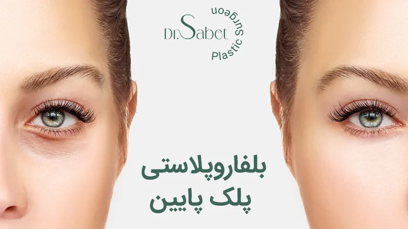 بلفاروپلاستی پلک پایین