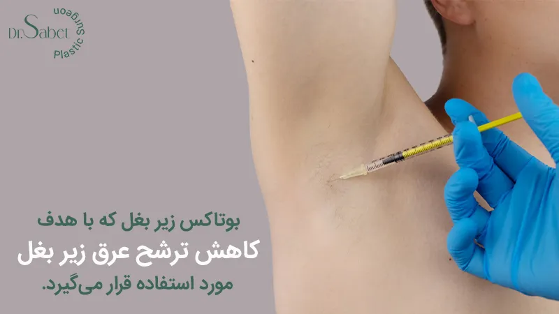 بوتاکس زیر بغل