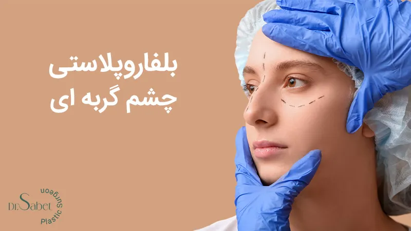 بلفاروپلاستی چشم گربه ای