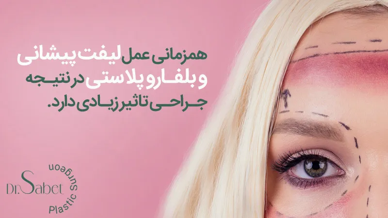 جراحی همزمان لیفت پیشانی و بلفاروپلاستی