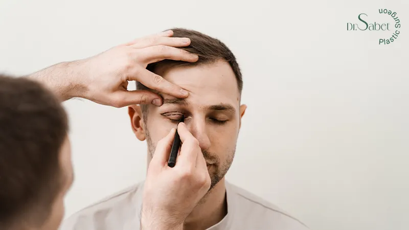 قبل از بلفاروپلاستی چشم گربه ای چه نکاتی باید رعایت شود؟