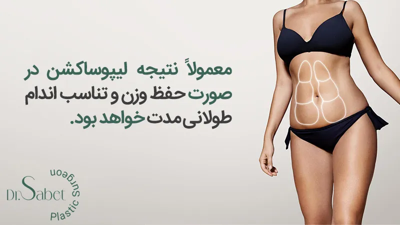 اقدامات پس از جراجی لیپوساکشن