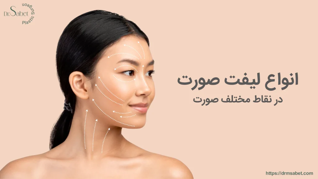 انواع لیفت صورت در نقاط مختلف صورت