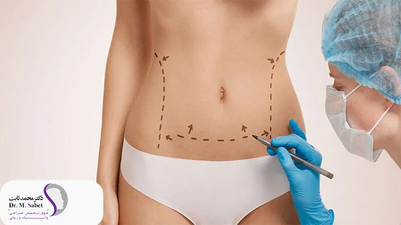 جراحی زیبایی شکم