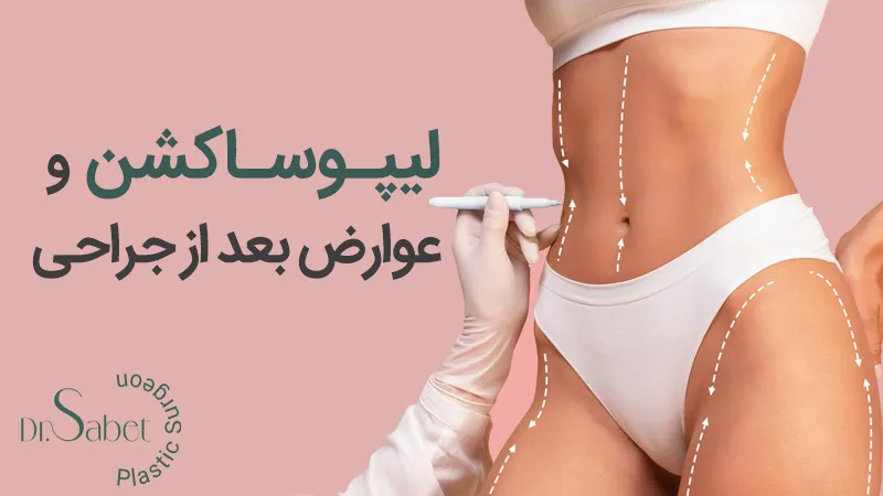 جراحی لیپوساکشن