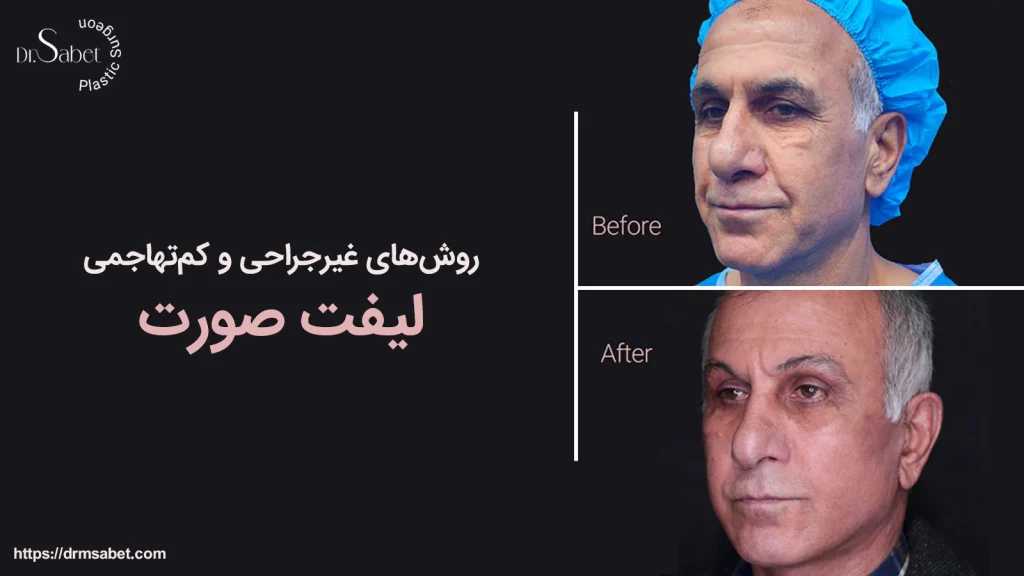 روش های غیرجراحی و کم تهاجمی لیفت