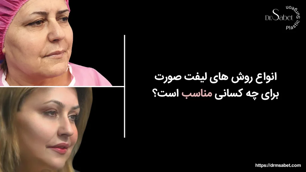 لیفت صورت مناسب چه کسی است؟