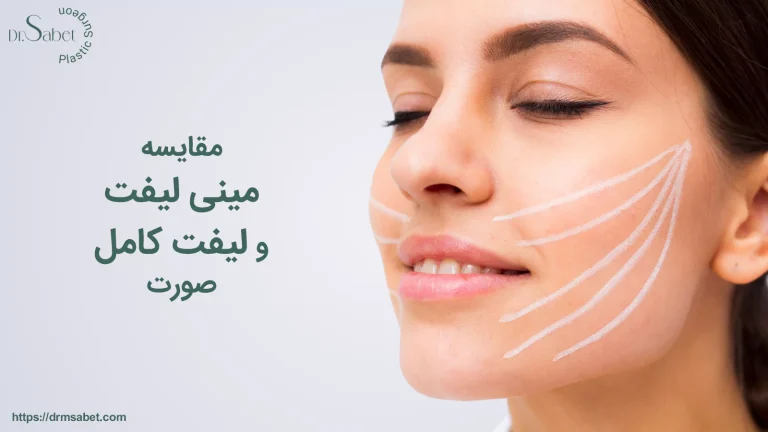 مقایسه مینی لیفت و لیفت کامل صورت