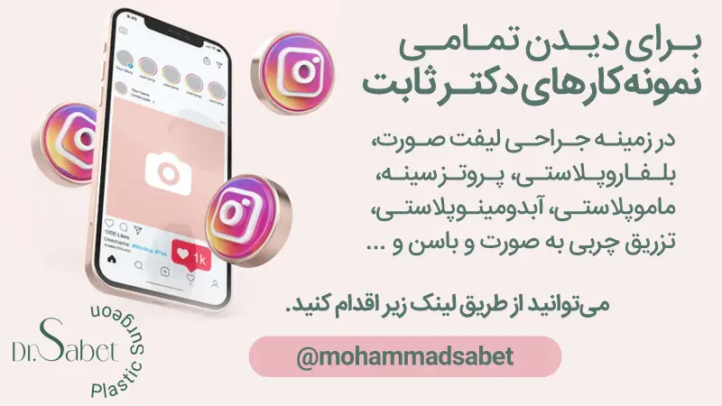 نمونه کارهای دکتر ثابت در اینستاگرام