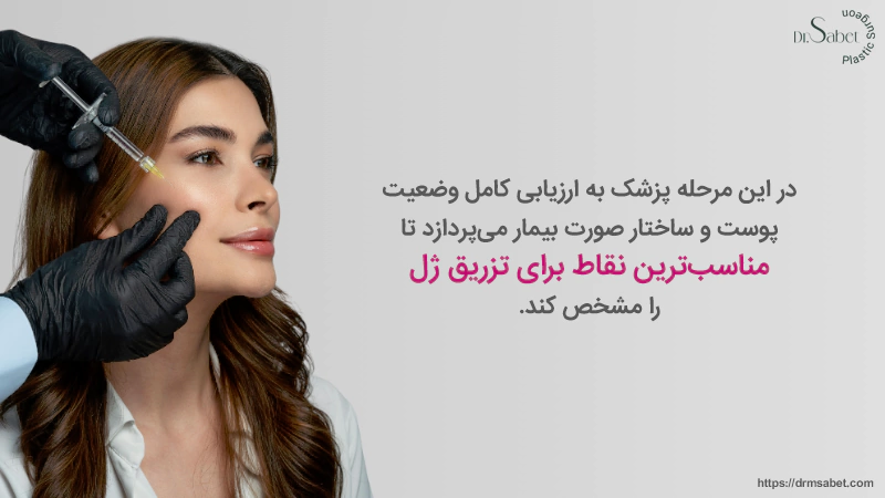 آماده_سازی قبل از تزریق ژل گونه