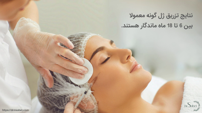 ماندگاری تزریق ژل گونه